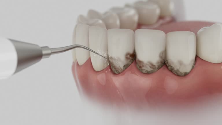 Reliable Dental Implants contractor in Marlinton, WV by Smile Center Dentistry